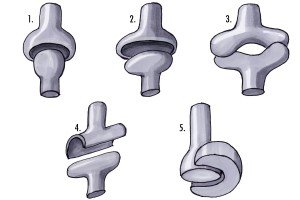Gelenkformen